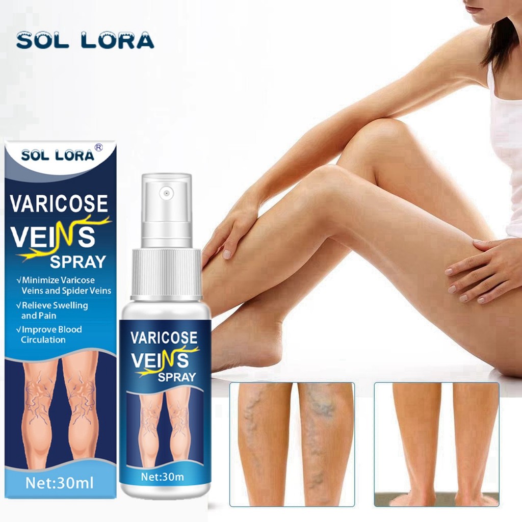 SOL LORA temu Vein Spray Leg Massage Earthworm Leg Vein Health Care Spray20260331