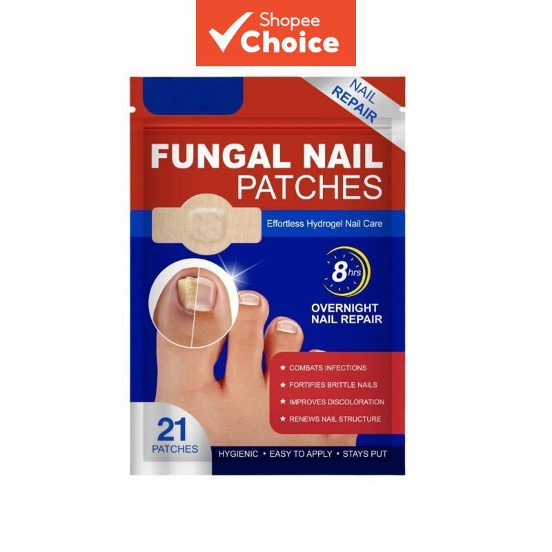 แผ่นแปะเล็บเชื้อราสําหรับเล็บเท้า 21 ชิ้น แผ่นดูแลสุขภาพเล็บ สําหรับเล็บที่เสียหาย ดูแลและซ่อมแซมเล็บเท้า