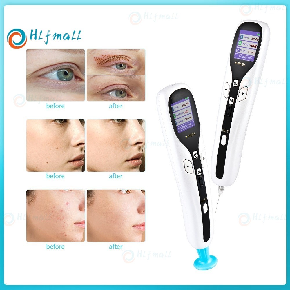 2 in1 ปากกาพลาสม่า Wart Freckle Removal