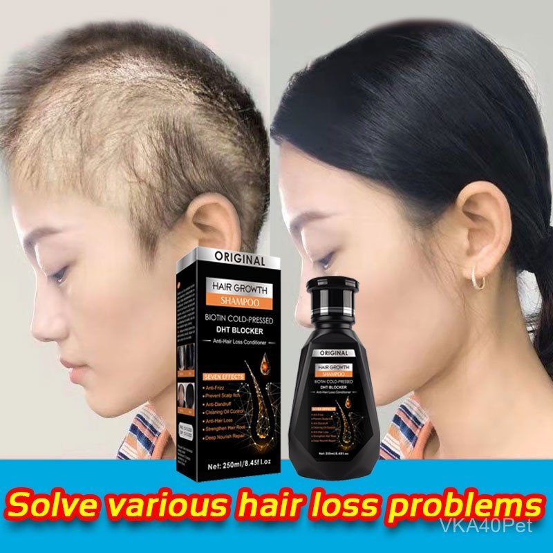PEIMEI Ginger Shampoo Hair Growth Shampoo Anti-Hair Loss Shampoo Natural Hair Growth 250ml