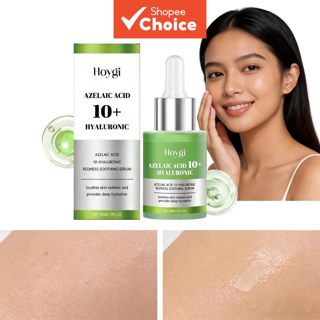 เซรั่มบรรเทาอาการแดง Hoygi กรดอะเซลาอิก 10% 30 มล. – ปลอบประโลม เติมความชุ่มชื้น เปล่งปลั่ง สําหรับผิวแพ้ง่าย ราคา ถูกที่สุด ดีลบีเคเค