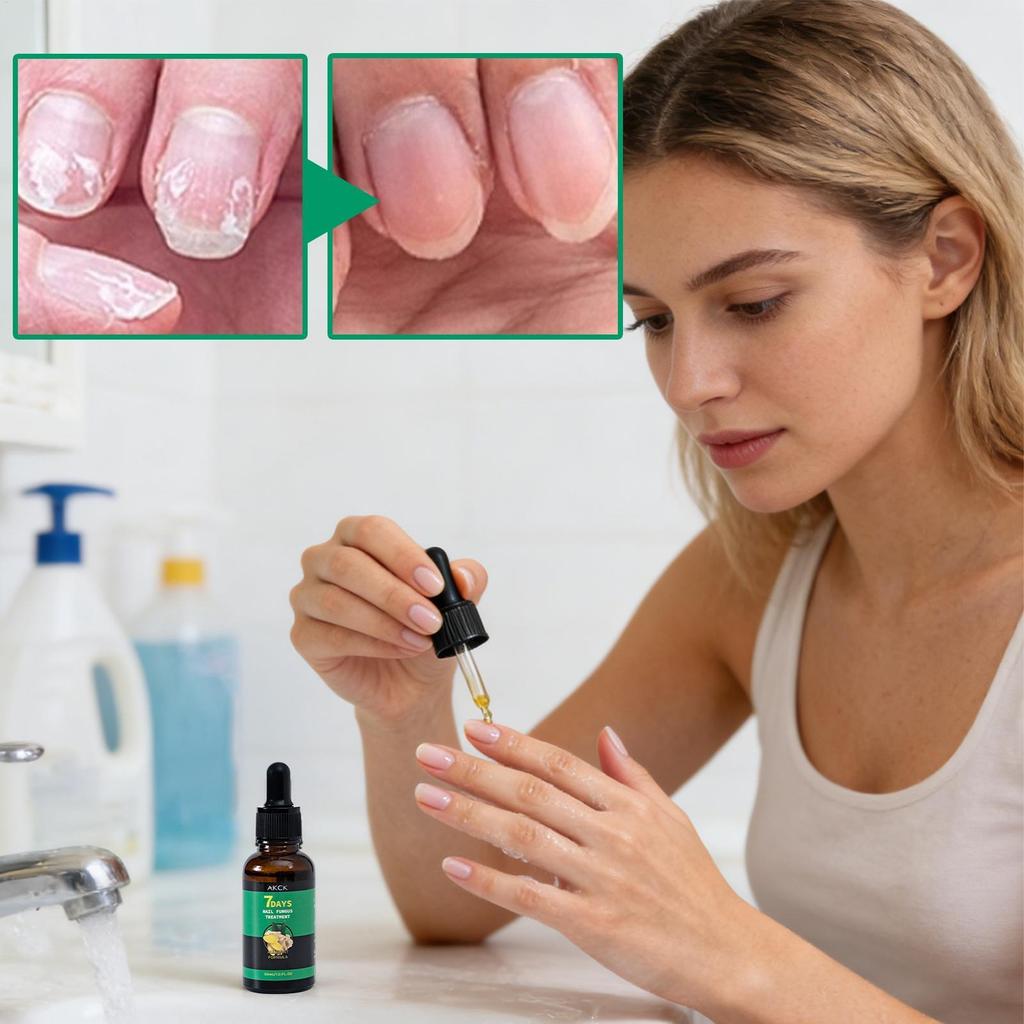 Nail Care Cuticle Oil 30ml Nourishing Hydrating Handle Solution น้ํามันเสริมเล็บสําหรับแยกอ่อนแอ huizoth