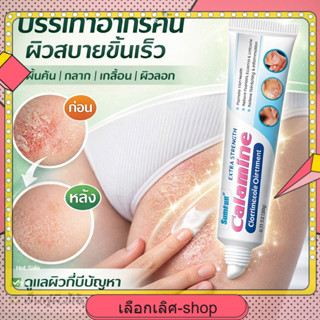 ครีมทาสังคัง สะเก็ดเงิน สมุนไพร 20g | แก้ผิวแพ้ ผิวแดง เกลื้…