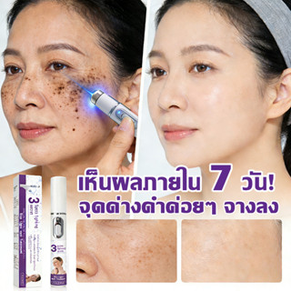 เลเซอร์รักษาฝ้ากระและจุดอายุได้อย่างมีประสิทธิภาพสว่างขึ้นแล…