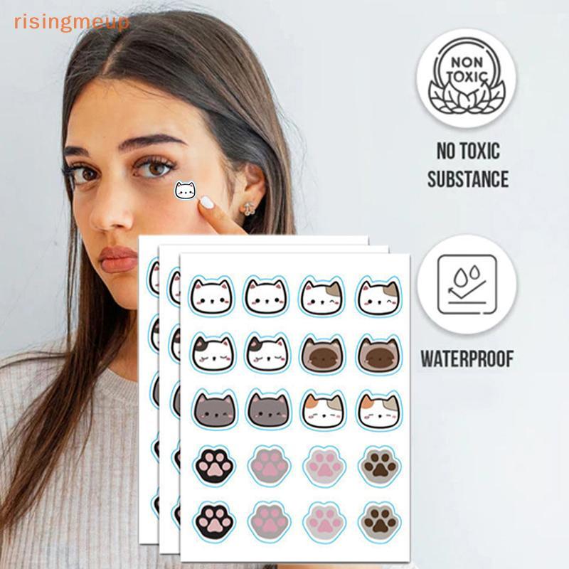 [risingmeup] 96 ชิ้น Cats Paw Acne Pimple Patch Stier Treatment Pimple Remover Tool Blemish Spot Fac