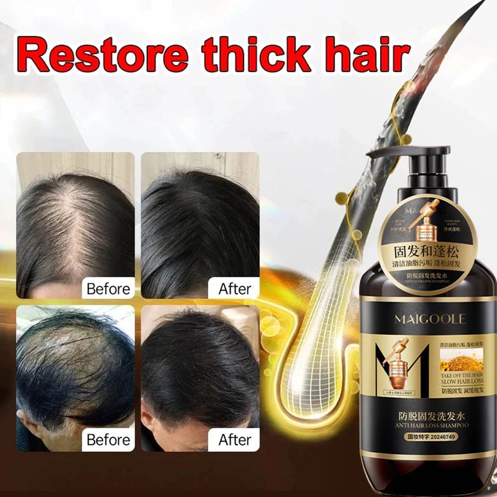 Hair growth shampoo Anti hair loss shampoo 400ml Herbal anti-hair loss improve hair quality