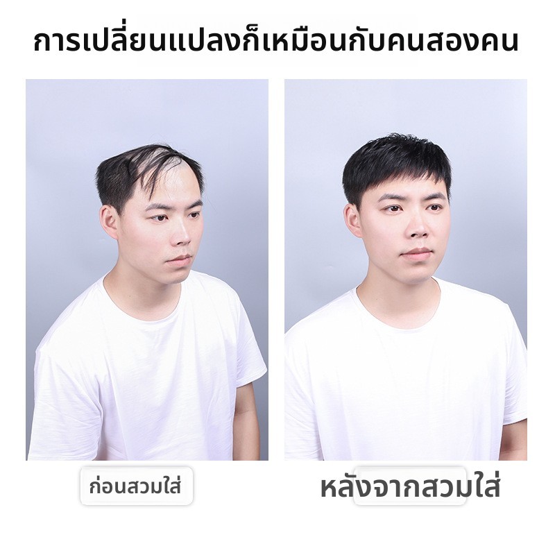 ชิ้นส่วนผมปลอมชั้นบนศีรษะสำหรับผู้ชาย ปกป้องพื้นหน้าขุ่มขึ้น ผมแท้ ชิ้นปกผมปลอมผู้ชาย