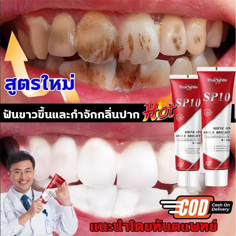 Hot Salling Smile ยาสีฟัน SP-10 ลดฟันเหลือง ฟันขาว ขจัดกลิ่นปาก ลมหายใจสดชื่น ฟอกสีฟัยาสีฟันโปรไบโอติกยาสีฟันฟันขาว