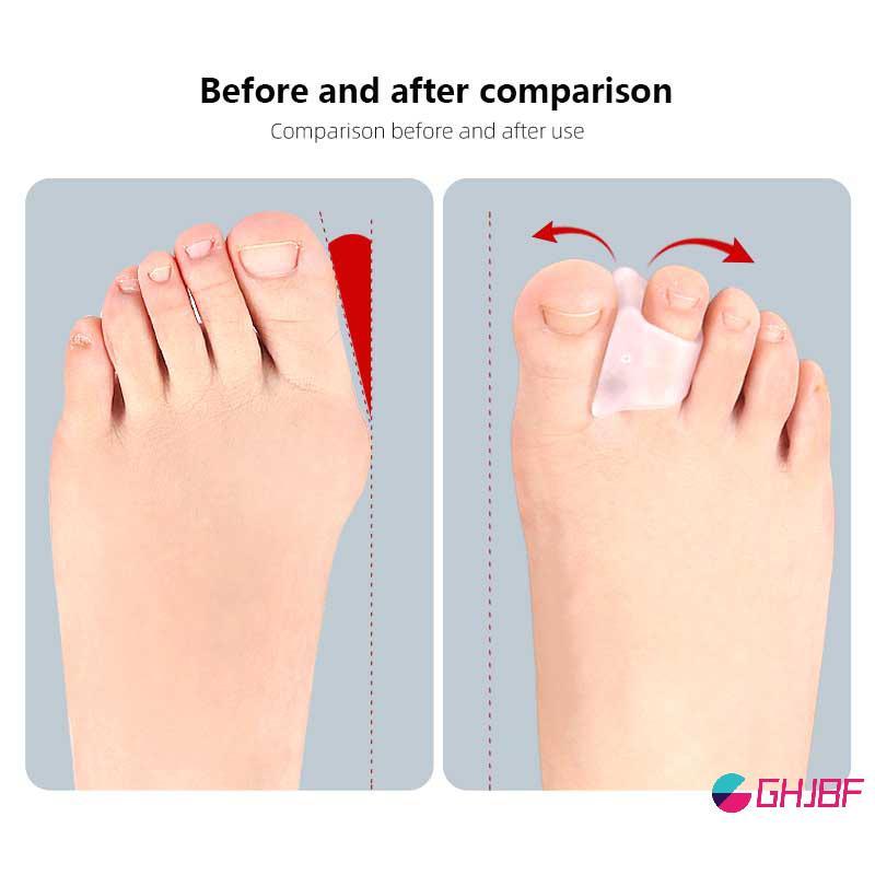 GHJBF] 2 ชิ้นค้อน Toe Straightener Hammertoe Corrector สําหรับ Curled Crooked Bent และ Claw Toes Lif