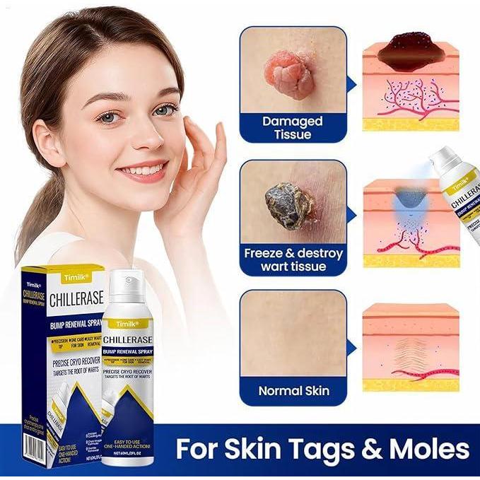 Chill Erase Bump Renewal Spray Body Moisturizer Rapid Absorption Lump Repair Spray ลดฝ้าผิว huaherth