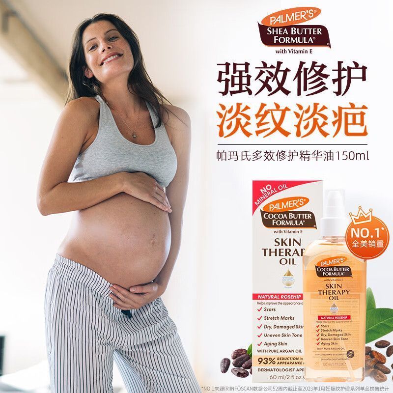Kash City Guigui Department Store (เชิงพาณิชย์ส่วนบุคคล) Palmers หญิงตั้งครรภ์เฉพาะรอยแตกลาย Oily Sk