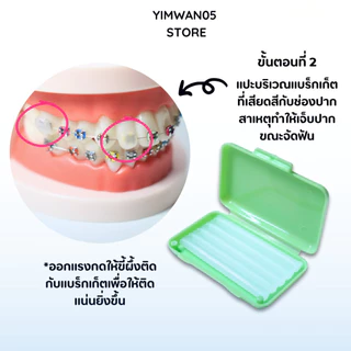 ขี้ผึ้งสำหรับคนจัดฟัน (เลือกกลิ่นได้) 1ตลับ แก้ปัญหาระคายเคืองช่องปาก 1ตลับมี5แท่ง