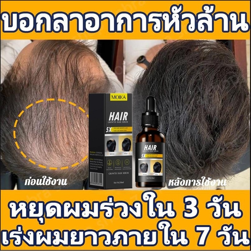 เซรั่มปลูกผม น้ำยาปลูกผมดก HAIR SERUM เร่งผมขึ้นใหม่ ปลูกผม สเปรย์ปปลูกผม เร่งผมยาว ลดผมร่วง บำรุงผม/ เส้นผมแข็งแ