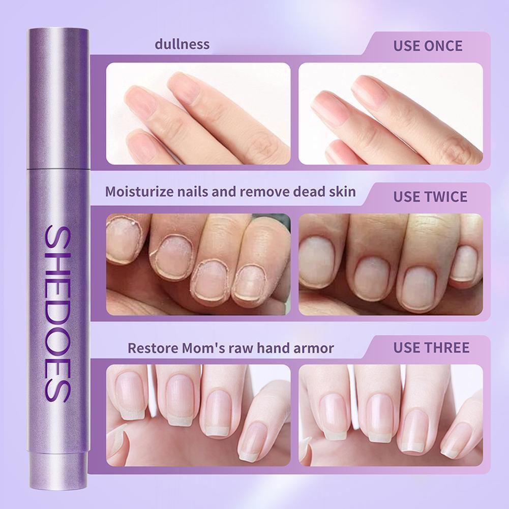 Shenot Nail Essence Pen Moisturizing Brightening Nail Skin Care Oil Repairing Nail U8v2