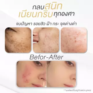 แป้งพัฟผสมรองพื้น ปกปิดเนียนกริบ UZI TWO WAY-POWDER SPF 50 PA++++ | ปกปิด กันแดด กันน้ำ คุมมัน ปิดรอย ผิวแพ้ง่ายใช้ได้