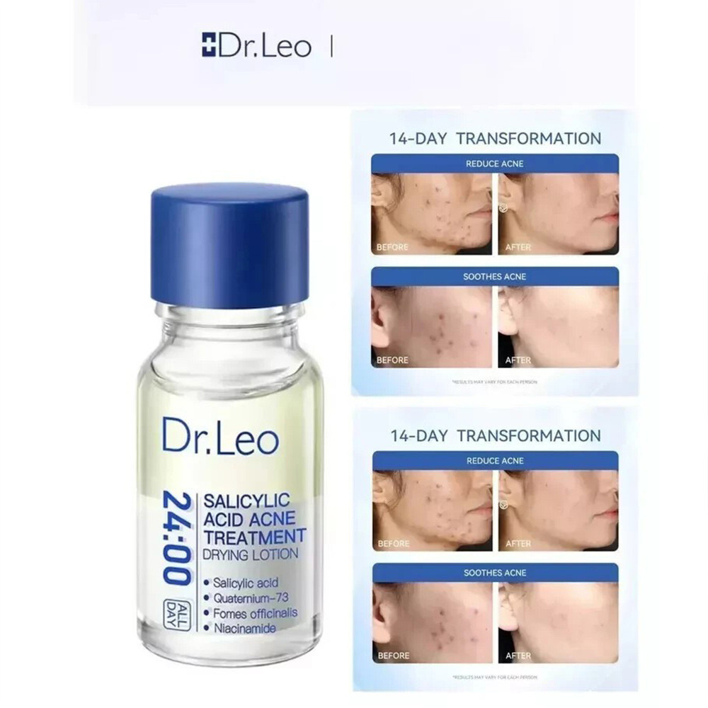 Dr.Leo Acne Essence Salicylic Acid Anti-acne Acne Serum Skincare