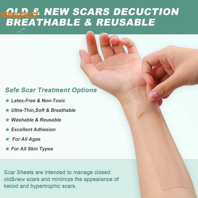 <Honeyheart> Professional Silicone Scar Sheets Scars Treatment Reusable Silicone Scar Strips Type Fo