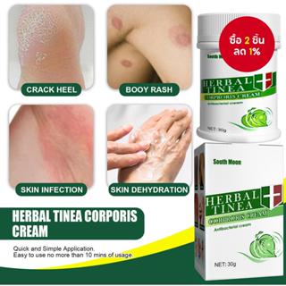 South Moon Anti-Itch Herbal Cream - บรรเทา Tina Corporis, Dr…
