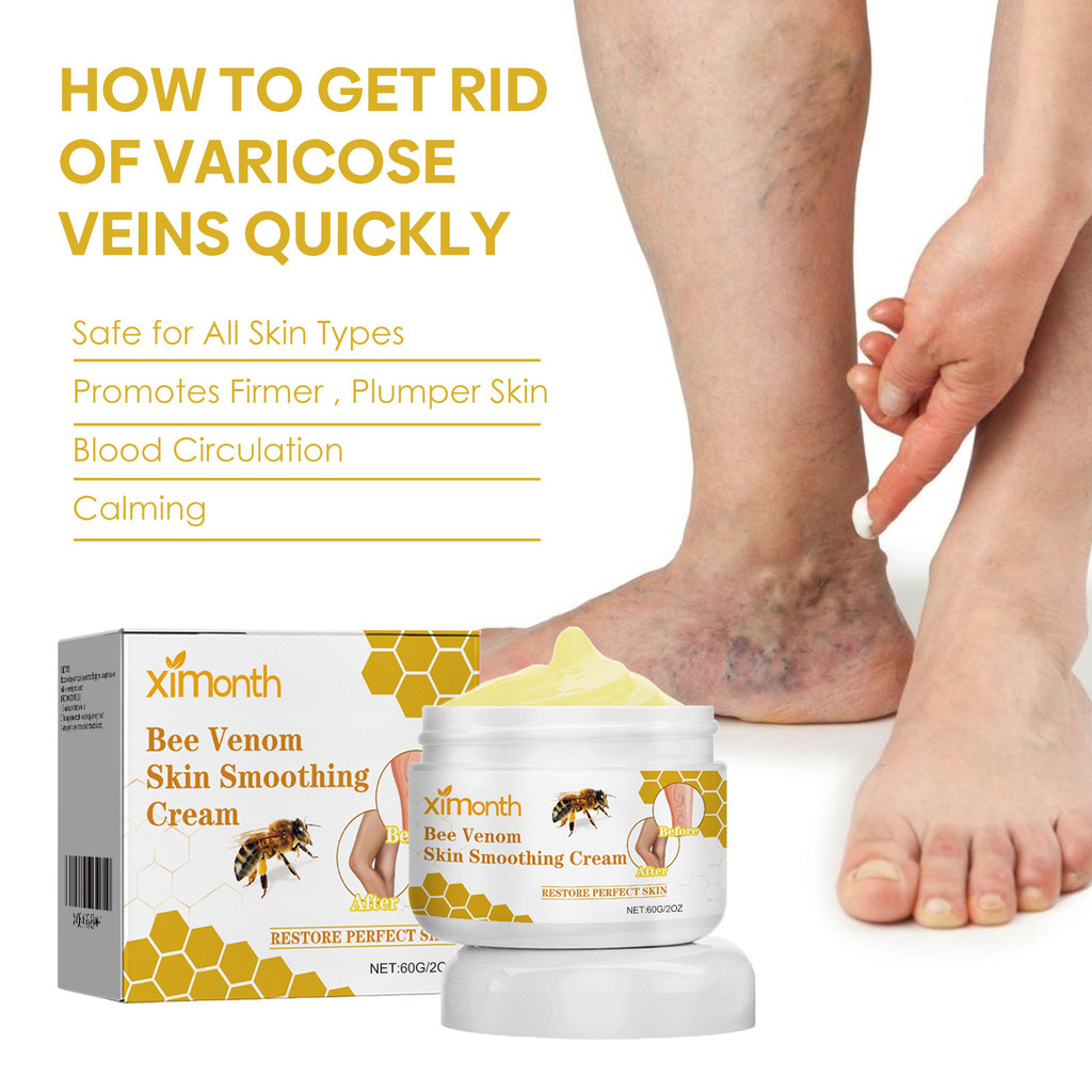 [คลังสินค้าพร้อม] Ximonth Bee Venom Leg Care Cream สบาย Leg Care Moisturizing Skin Body Care Cream W