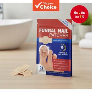 แผ่นแปะแก้ไขเล็บขบ 21 ชิ้น สําหรับดูแลเล็บเท้าที่เสียหายจากเ…