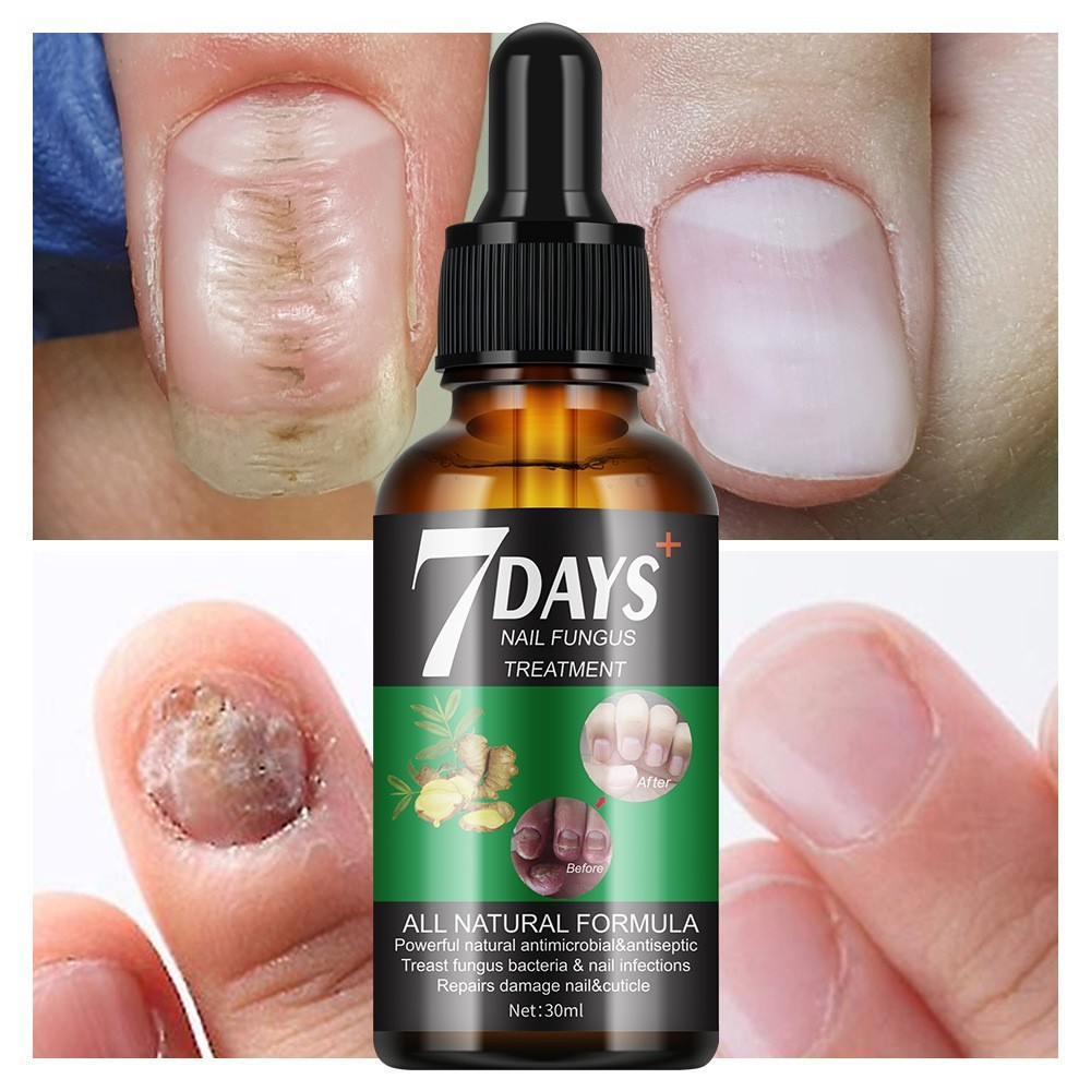 Nail Nutrient Liquid Repair Nourishing Nail Brightening Essence Nail Moisturizing Care Liquid Nail R