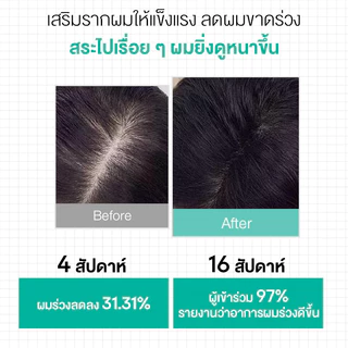 [ปริมาณ 900 มล ขนาดขายดี！] Cokki anti-hair loss shampoo ยาสระผม ลดผมขาดหลุดร่วง