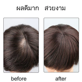 จัดส่งฟรี🔥วิกผมแท้เต็มชิ้น วิกผมเต็มชิ้น ทำจากผมมนุษย์ 100% เต็มชิ้น วิก แฮร์พีชทดแทนด้านบน วิกสำหรับผู้หญิงทุกวัย สำหรับโอกาสพิเศษ ฐานระบายอากาศได้ดี สวมใส่สบาย