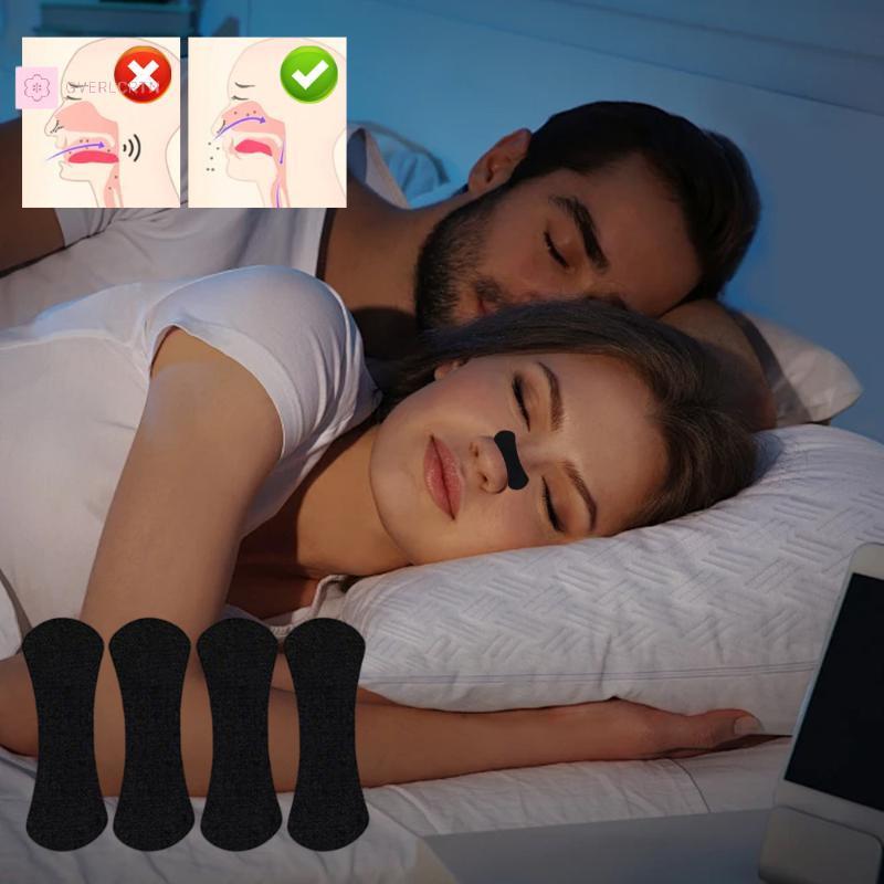 [GRL] 30 ชิ้นแถบจมูกสําหรับ Snoring Nasal Patch Correction การขยายทางกายภาพ Breathable Better Sleep 