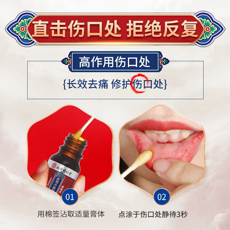 Nanjing Tongrentang Medical Gel Oral Ulcer Spray Pop-up Bad Mouth Tongue Oral Ulcer Pop-up Spray 202