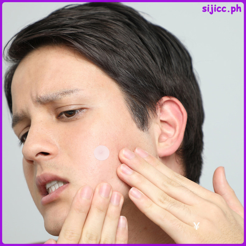 หน้าผาก Dark Spot Face Pimple Dots แพทช์สี 1.20X1.20X0.10CM Beige sijicc