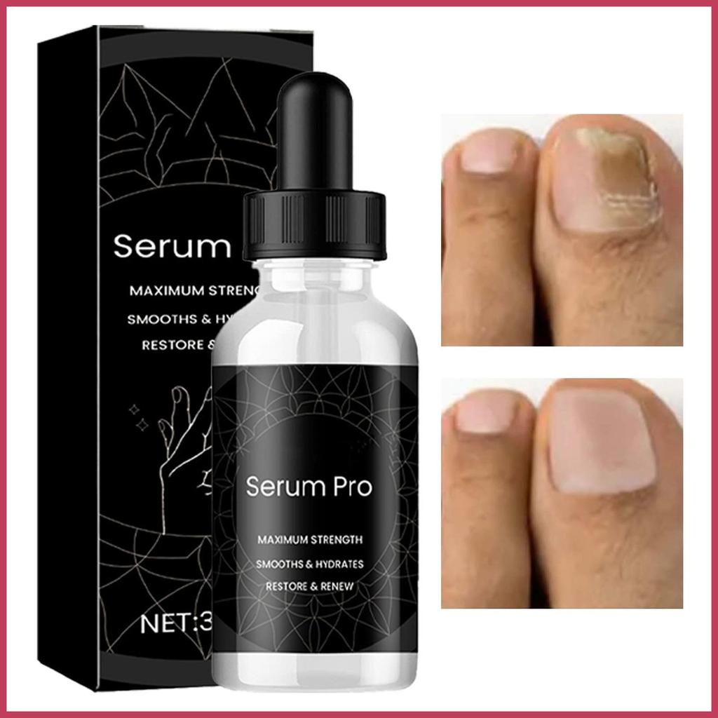 Nail Strengthener 30ml Natural Strengthener Hardener Solution Broken Nail Repair สําหรับ Manicurist 