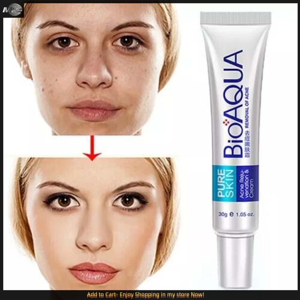 BIOAQUA PURE SKIN Acne Scar Removal Rejuvenation Cream ความงามและการดูแล - 30g Acne Cream Acne Scar 