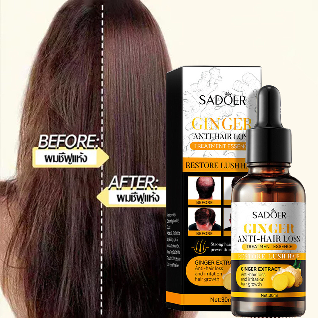 SADOER GINGER HAIR GROWTH SERUM เซรั่มขิงบำรุงผม ลดผมร่วง กระตุ้นปลูกผมใหม่ บำรุงรากผมให้แข็งแรง