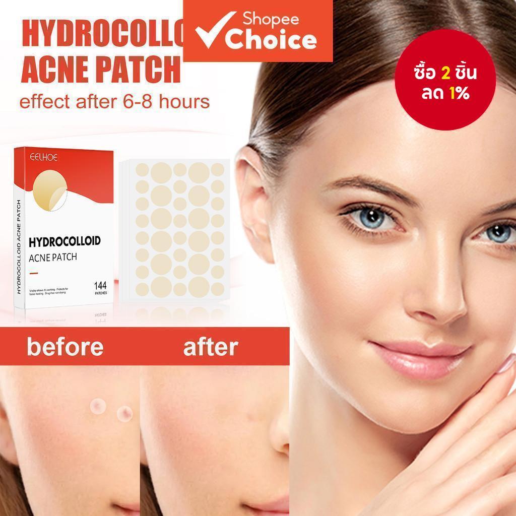 แผ่นแปะสิวไฮโดรคอลลอยด์จาก Hero Cosmetics สําหรับลดสิวและหัวขาวใน 1 คืน แผ่นสติ๊กเกอร์สําหรับใบหน้าและผิว (36 ชิ้น)