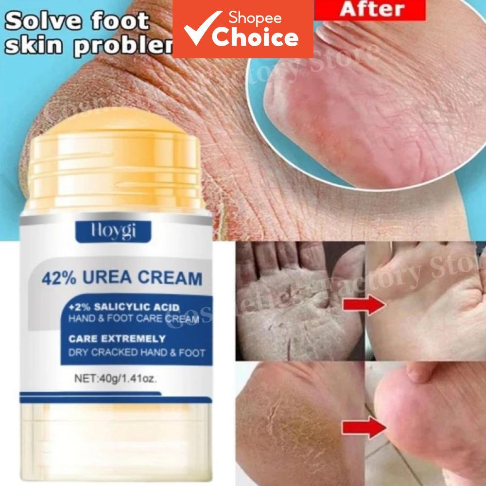 ครีมยูเรียเข้มข้น 60% และว่านหางจระเข้ 40 กรัม สําหรับเท้า - บํารุงล้ําลึกและให้ความชุ่มชื้นแก่เท้าแห้งแตก อ่อนโยนต่อการผลัดเซลล์ผิวประจําวัน อัพเกรดใหม่