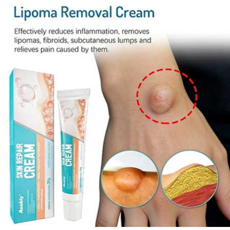 Aeekiy Herbal Recovery Cream: Targets Eczema, Fungal Rashes & Itchy Inflammation