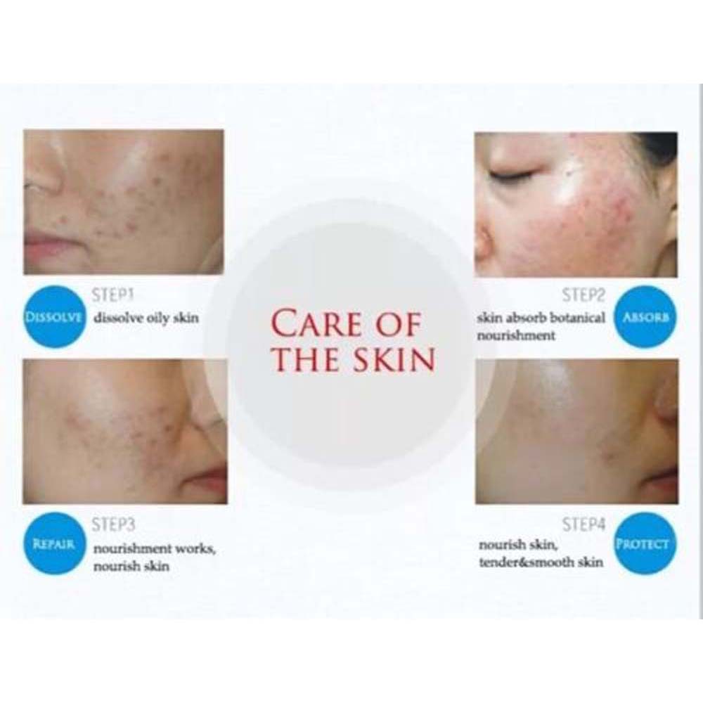 BIOAQUA PURE SKIN Acne Scar Removal Rejuvenation Cream ความงามและดูแล - 30g Acne Cream Acne Scar Rem