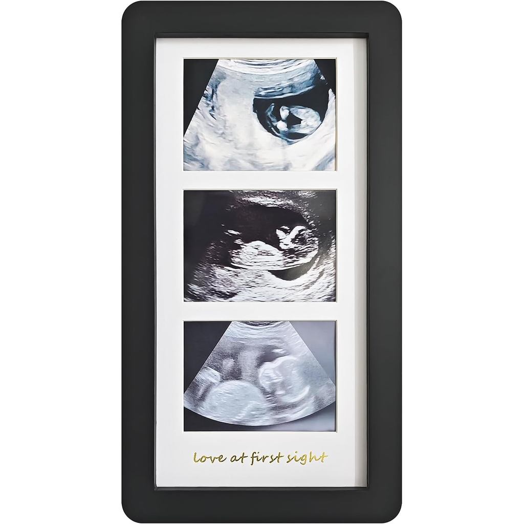 Love at First Sight Ultrasound Picture Frames,Triple Ultrasound Picture Frame,Snogram Pictures,Pragn