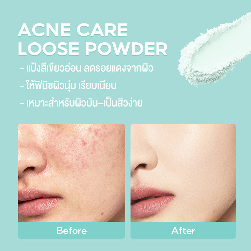 Oni Acne Care Loose Powder 50g โอนิ แป้งฝุ่นสำหรับคนเป็นสิว. - รูปที่ 3