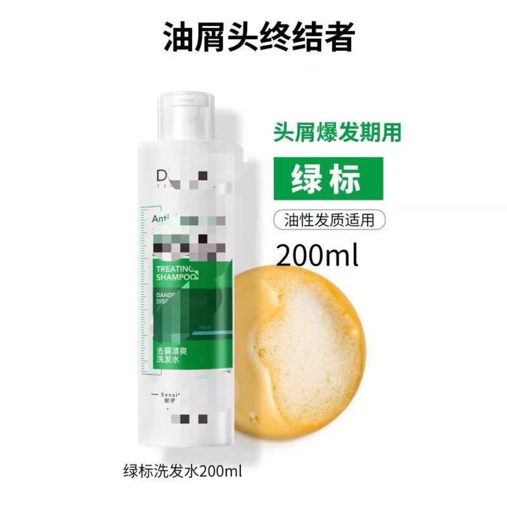 Popular~Wei Green Label Shampoo200ml Red Label Shampoo for Oil Control and Dandruff Removal with Sel