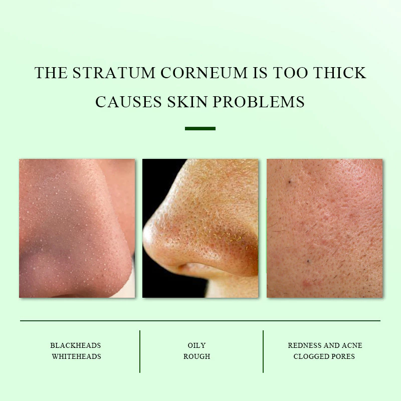 SHE Eureka Exfoliating Brightening Gel 50g thumbnail 3