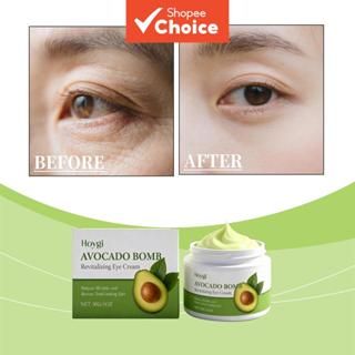 ครีมบํารุงรอบดวงตาอโวคาโด 30 กรัม ผสมคอลลาเจนไฮโดรไลซ์และกาแ…