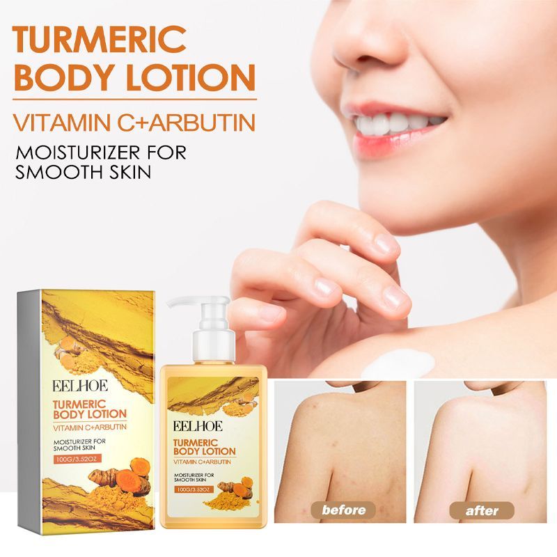 Hot Sale#EELHOE Turmeric Body Lotion Moisturizing, hydrating, nourishing, brightening skin, refreshi