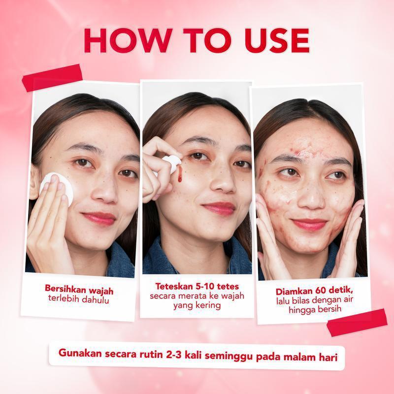 พร้อมสต็อก Fast Shipping B5 PEELING SOLUTION Facial Exfoliating SOLUTION TK ขายร้อนทําความสะอาดลึก M