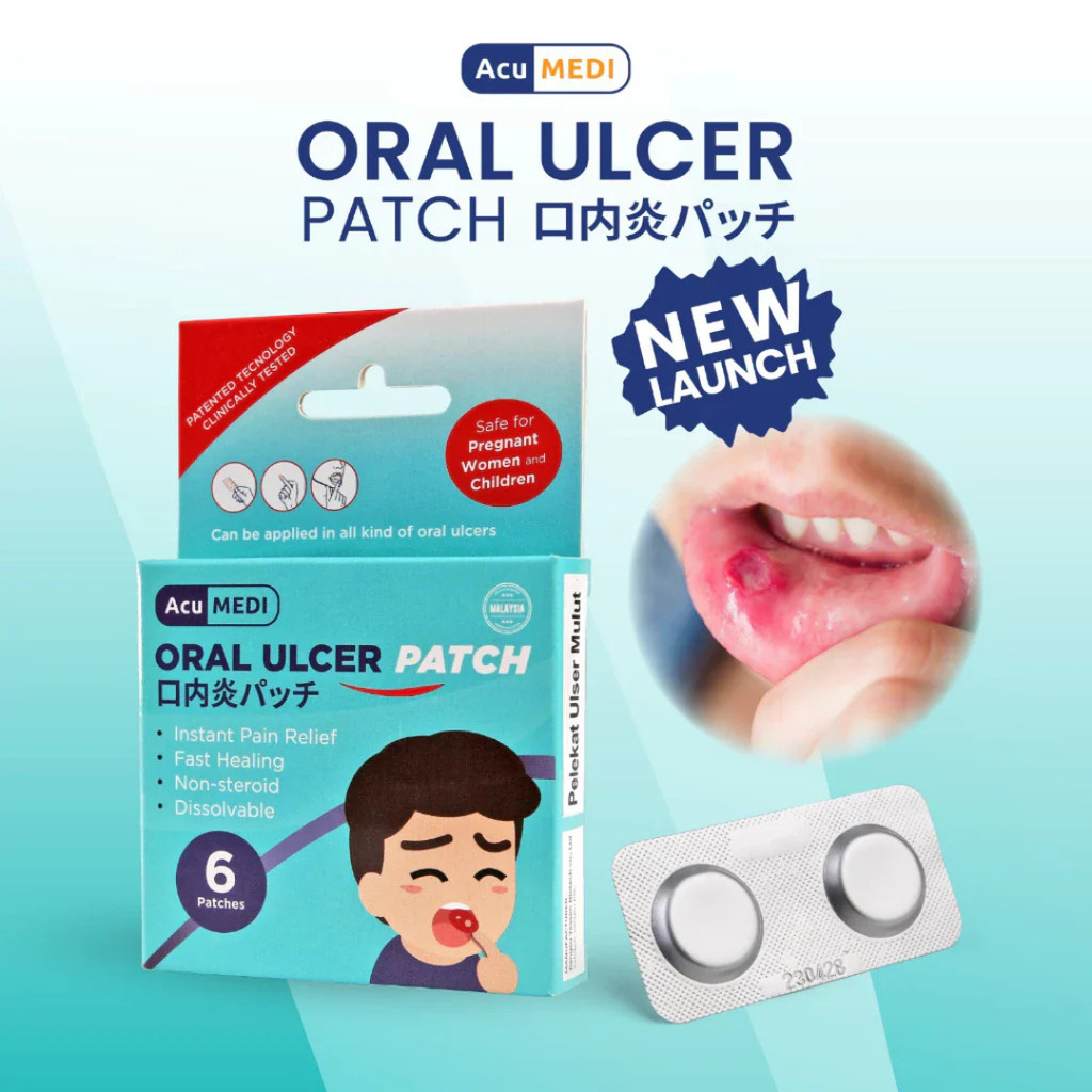 AcuMedic Oral Ulcer Patch 6S
