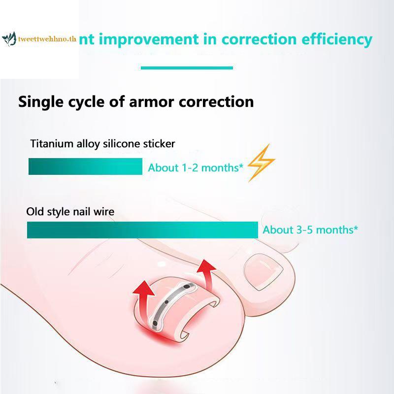 Tweettwehno 2 ชิ้นคุด Toenail Corrector เครื่องมือ Pedicure กู้คืน Embed Toe เล็บ Professional คุด T