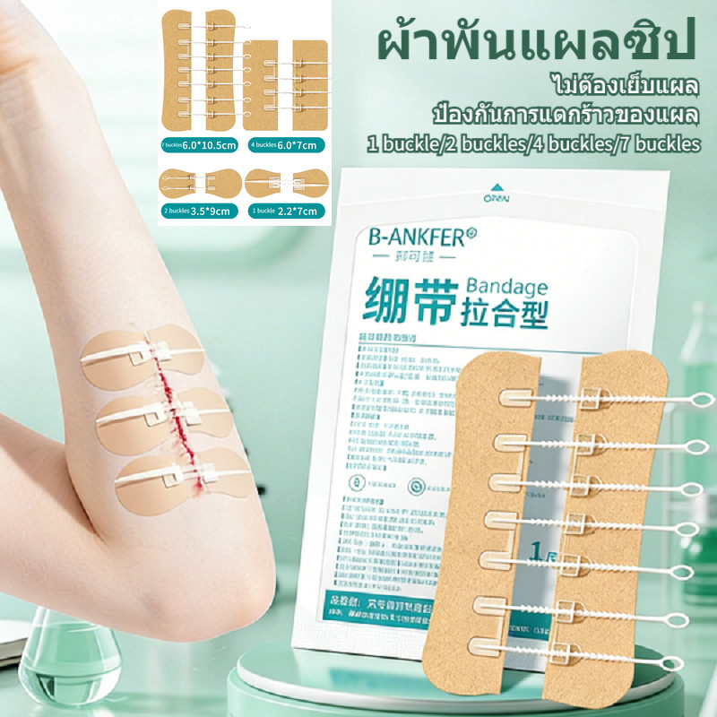 1 ชิ้น ประเภทดึงปิดแผ่นปิดแผลไม่ต้องเย็บ บรรจุแยกส่วน ดึงรั้งเพื่อปิดแผล ช่วยให้แผลเรียบเนียน  [1/2/4/7buckle]