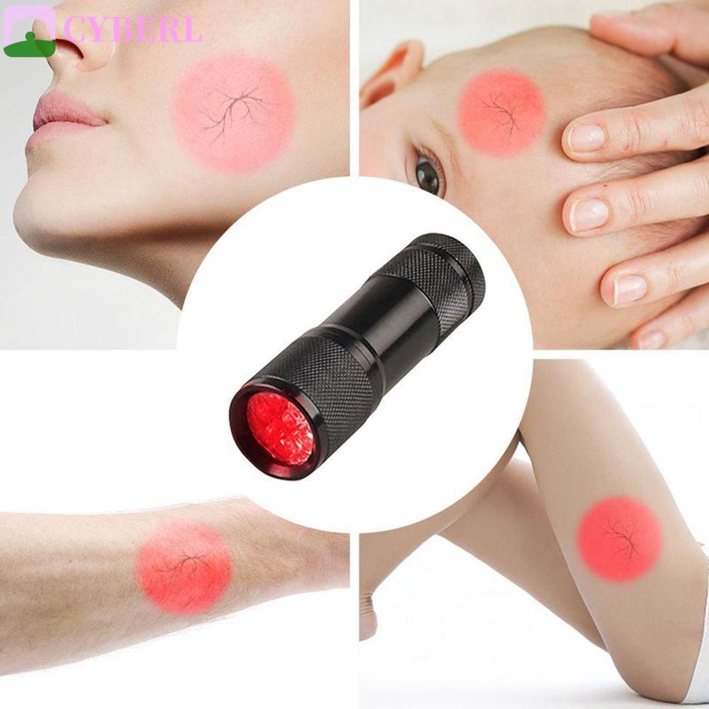 CYBERLINX Vein Finder เครื่องตรวจเส้นเลือดแบบ LED อุปกรณ์แพทย์สำหรับการหาเส้นเลือดด้วยเทคโนโลยีอินฟราเรด