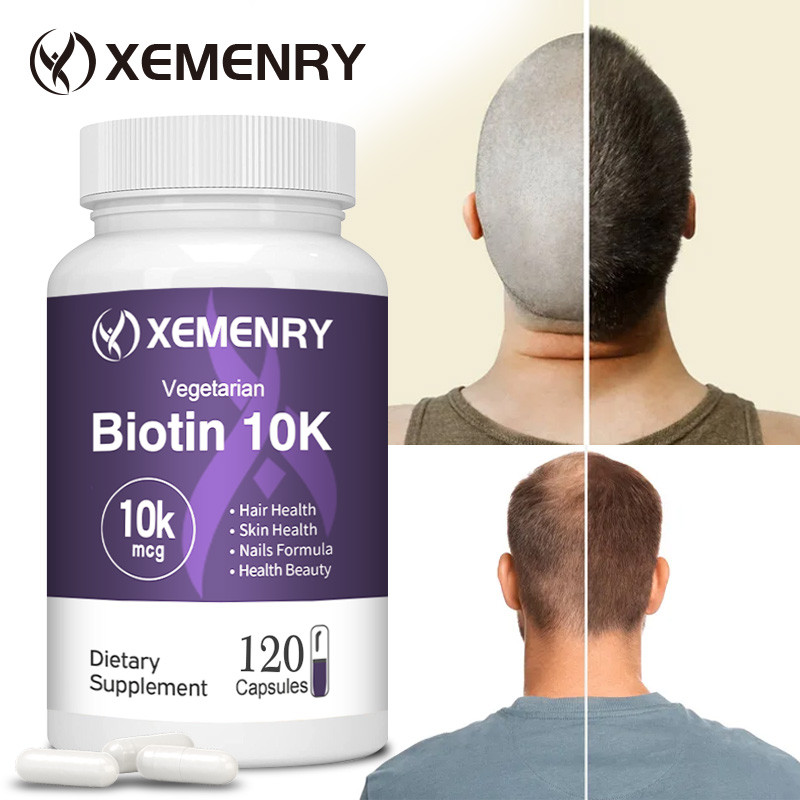 XEMENRY Biotin, Coconut OilHealthy Hair, Healthy Skin, Healthy Nails ผลิตภัณฑ์เสริมอาหาร, ปราศจากกลูเตน, Made in USA. 30/60/120 แคปซูล