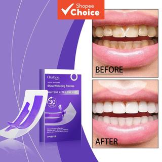 Teeth Cleaning Patches 7pcs for Daily Dental Care – Gentle Whitening & Gum Health for Sensitive Teeth